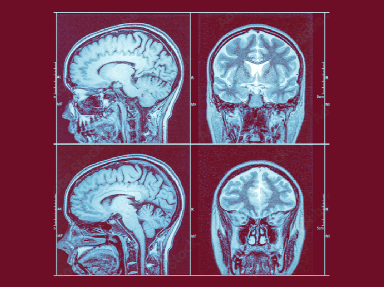 MRI_Photos