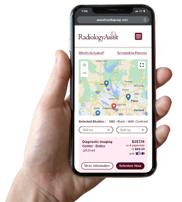 A hand holds a smartphone displaying the RadiologyAssist website, showing a map with imaging centers near Dallas and MRI brain scan options, along with pricing and scheduling details.