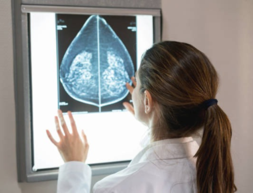 Mammogram Cost in Phoenix AZ for Self-Pay Patients Starting from $140